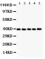 CXCR6 Antibody - CXCR6 antibody Western blot. All lanes: Anti CXCR6 at 0.5 ug/ml. Lane 1: Rat Brain Tissue Lysate at 50 ug. Lane 2: Rat Testis Tissue Lysate at 50 ug. Lane 3: Rat Spleen Tissue Lysate at 50 ug. Lane 4: Mouse Brain Tissue Lysate at 50 ug. Lane 5: Mouse Testis Tissue Lysate at 50 ug. Predicted band size: 39 kD. Observed band size: 39 kD.