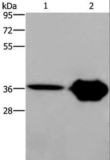 CXCR6 Antibody - Western blot analysis of Human fetal brain and mouse brain tissue, using CXCR6 Polyclonal Antibody at dilution of 1:350.