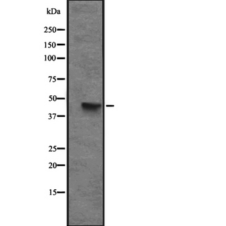 CXCR6 Antibody - Western blot analysis of CXCR6 expression in HEK293 cells. The lane on the left is treated with the antigen-specific peptide.