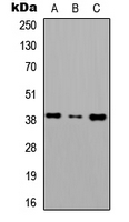 CXCR6 Antibody - Western blot analysis of CD186 expression in HEK293T (A); Raw264.7 (B); H9C2 (C) whole cell lysates.