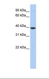 CXCR6 Antibody - Placenta lysate. Antibody concentration: 1.0 ug/ml. Gel concentration: 12%.  This image was taken for the unconjugated form of this product. Other forms have not been tested.