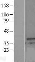 CXorf21 Protein - Western validation with an anti-DDK antibody * L: Control HEK293 lysate R: Over-expression lysate