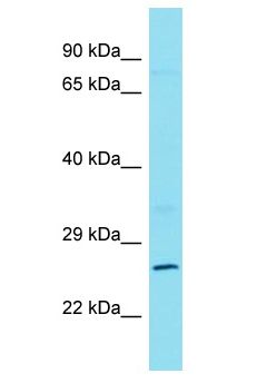 CXorf23 Antibody - CXorf23 antibody Western Blot of NCI-H226. Antibody dilution: 1 ug/ml.  This image was taken for the unconjugated form of this product. Other forms have not been tested.