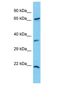 CXorf23 Antibody - CXorf23 antibody Western Blot of COLO205. Antibody dilution: 1 ug/ml.  This image was taken for the unconjugated form of this product. Other forms have not been tested.