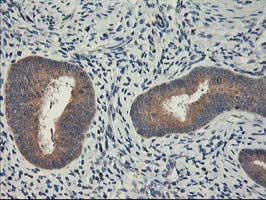 CXorf26 Antibody - IHC of paraffin-embedded Human endometrium tissue using anti-CXorf26 mouse monoclonal antibody.