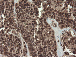 CXorf26 Antibody - IHC of paraffin-embedded Carcinoma of Human pancreas tissue using anti-CXorf26 mouse monoclonal antibody. (Heat-induced epitope retrieval by 10mM citric buffer, pH6.0, 100C for 10min).
