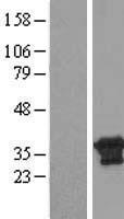 CXorf26 Protein - Western validation with an anti-DDK antibody * L: Control HEK293 lysate R: Over-expression lysate