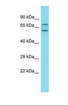 CXorf30 Antibody - Western blot of Human Fetal Liver. CXorf30 antibody dilution 1.0 ug/ml.  This image was taken for the unconjugated form of this product. Other forms have not been tested.