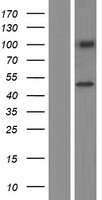 CXorf36 Protein - Western validation with an anti-DDK antibody * L: Control HEK293 lysate R: Over-expression lysate