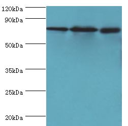 CXXC1 / CGBP Antibody - Western blot. All lanes: CXXC-type zinc finger protein 1 antibody at 2 ug/ml. Lane 1: THP-1 whole cell lysate. Lane 2: mouse liver tissue. Lane 2: mouse spleen tissue. secondary Goat polyclonal to rabbit at 1:10000 dilution. Predicted band size: 76 kDa. Observed band size: 76 kDa.