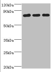 CXXC1 / CGBP Antibody - Western blot All lanes: CXXC-type zinc finger protein 1 antibody at 2µg/ml Lane 1: THP-1 whole cell lysate Lane 2: Mouse liver tissue Lane 2: Mouse spleen tissue Secondary Goat polyclonal to rabbit IgG at 1/10000 dilution Predicted band size: 76, 77 kDa Observed band size: 76 kDa