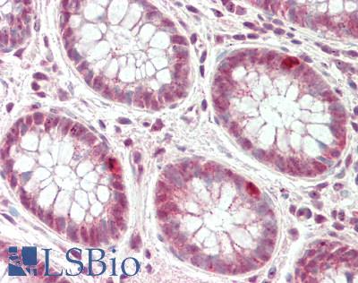 CXXC1 / CGBP Antibody - Human Colon: Formalin-Fixed, Paraffin-Embedded (FFPE).  This image was taken for the unconjugated form of this product. Other forms have not been tested.