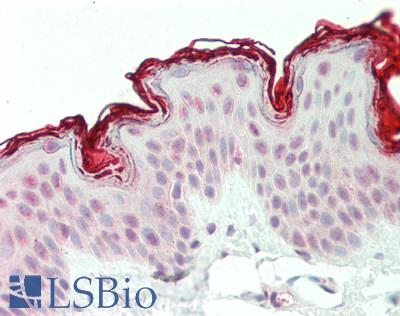 CXXC1 / CGBP Antibody - Human Skin: Formalin-Fixed, Paraffin-Embedded (FFPE).  This image was taken for the unconjugated form of this product. Other forms have not been tested.