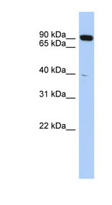 CXXC1 / CGBP Antibody - CXXC1 / CGBP antibody wWestern blot of THP-1 cell lysate.  This image was taken for the unconjugated form of this product. Other forms have not been tested.
