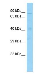 CXXC1 / CGBP Antibody - CXXC1 / CGBP antibody Western Blot of Rat Testis.  This image was taken for the unconjugated form of this product. Other forms have not been tested.