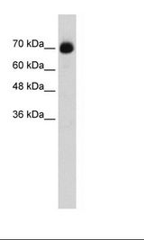 CXXC1 / CGBP Antibody - Transfected 293T Cell Lysate.  This image was taken for the unconjugated form of this product. Other forms have not been tested.