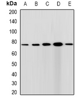 CXXC1 / CGBP Antibody - Western blot analysis of CGBP expression in HepG2 (A); HeLa (B); A431 (C); mouse spleen (D); rat testis (E) whole cell lysates.