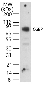 CXXC1 / CGBP Antibody - Western blot of CGBP using antibody at 1:1000 dilution against 15 ug/lane of human spleen lysate. Immunoreactivity was determined using SuperSignal system (Pierce) and by exposing to the film for 15 minutes.