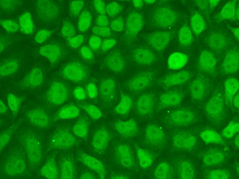 CXXC1 / CGBP Antibody - Immunofluorescence analysis of A-549 cells using CXXC1 antibody.