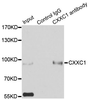 CXXC1 / CGBP Antibody - Immunoprecipitation analysis of 200ug extracts of HepG2 cells using 3ug CXXC1 antibody. Western blot was performed from the immunoprecipitate using CXXC1 antibody at a dilition of 1:500.