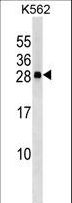 CXXC4 Antibody - CXXC4 Antibody western blot of K562 cell line lysates (35 ug/lane). The CXXC4 antibody detected the CXXC4 protein (arrow).