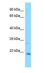 CXXC4 Antibody - CXXC4 antibody Western Blot of MCF7.  This image was taken for the unconjugated form of this product. Other forms have not been tested.