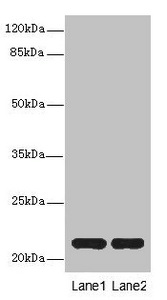 CXXC4 Antibody - Western blot All Lanes: CXXC4antibody at 3.6ug/ml Lane 1 : Mouse liver tissue Lane 2 : Mouse kidney tissue Secondary Goat polyclonal to Rabbit IgG at 1/10000 dilution Predicted band size: 21 kDa Observed band size: 21 kDa