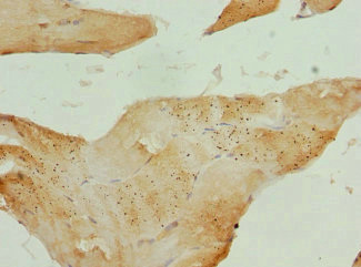 CXXC4 Antibody - Immunohistochemistry of paraffin-embedded human skeletal muscle tissue at dilution 1:100
