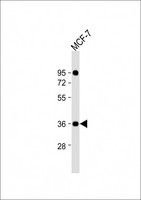 CXXC5 Antibody - Anti-CXXC5 Antibody (N-Term) at 1:2000 dilution + MCF-7 whole cell lysate Lysates/proteins at 20 ug per lane. Secondary Goat Anti-Rabbit IgG, (H+L), Peroxidase conjugated at 1:10000 dilution. Predicted band size: 33 kDa. Blocking/Dilution buffer: 5% NFDM/TBST.