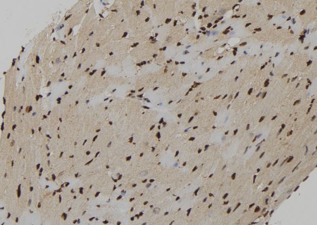 CXXC5 Antibody - 1:100 staining mouse heart tissue by IHC-P. The sample was formaldehyde fixed and a heat mediated antigen retrieval step in citrate buffer was performed. The sample was then blocked and incubated with the antibody for 1.5 hours at 22°C. An HRP conjugated goat anti-rabbit antibody was used as the secondary.