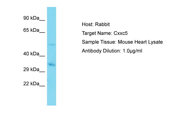 CXXC5 Antibody -  This image was taken for the unconjugated form of this product. Other forms have not been tested.