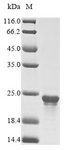 dnaK Protein - (Tris-Glycine gel) Discontinuous SDS-PAGE (reduced) with 5% enrichment gel and 15% separation gel.