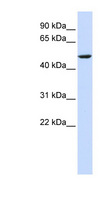 CYB561 Antibody - CYB561 antibody Western blot of HeLa lysate. This image was taken for the unconjugated form of this product. Other forms have not been tested.