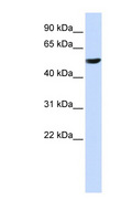 CYB561 Antibody - CYB561 antibody Western blot of HeLa lysate. This image was taken for the unconjugated form of this product. Other forms have not been tested.