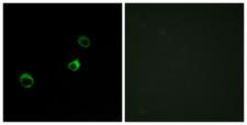 CYB561D1 Antibody - Immunofluorescence analysis of MCF-7 cells, using Cytochrome b561 D1 Antibody. The picture on the right is blocked with the synthesized peptide.