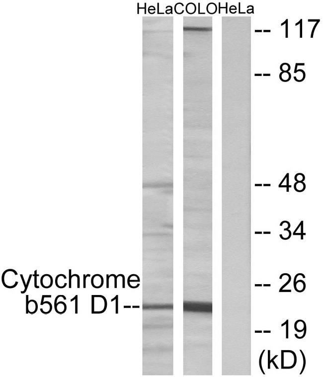CYB561D1 Antibody - Western blot analysis of lysates from HeLa cells and COLO205 cells, using Cytochrome b561 D1 Antibody. The lane on the right is blocked with the synthesized peptide.