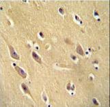 CYB561D1 Antibody - CYB561D1 antibody immunohistochemistry of formalin-fixed and paraffin-embedded human brain tissue followed by peroxidase-conjugated secondary antibody and DAB staining.