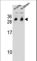 CYB561D1 Antibody - CYB561D1 Antibody western blot of mouse lung,spleen tissue lysates (35 ug/lane). The CYB561D1 antibody detected the CYB561D1 protein (arrow).