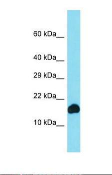 CYB561D1 Antibody - Western blot of Human COLO205. CYB561D1 antibody dilution 1.0 ug/ml.  This image was taken for the unconjugated form of this product. Other forms have not been tested.