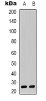 CYB561D1 Antibody - Western blot analysis of CYB561D1 expression in HeLa (A); NIH3T3 (B) whole cell lysates.