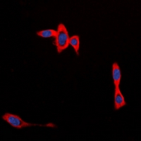 CYB561D1 Antibody - Immunofluorescent analysis of CYB561D1 staining in MCF7 cells. Formalin-fixed cells were permeabilized with 0.1% Triton X-100 in TBS for 5-10 minutes and blocked with 3% BSA-PBS for 30 minutes at room temperature. Cells were probed with the primary antibody in 3% BSA-PBS and incubated overnight at 4 deg C in a humidified chamber. Cells were washed with PBST and incubated with a DyLight 594-conjugated secondary antibody (red) in PBS at room temperature in the dark. DAPI was used to stain the cell nuclei (blue).