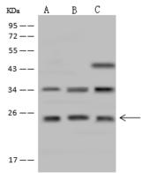CYB561D1 Antibody - Anti-CYB561D1 rabbit polyclonal antibody at 1:500 dilution. Lane A: Hela Whole Cell Lysate. Lysates/proteins at 30 ug per lane. Secondary: Goat Anti-Rabbit IgG (H+L)/HRP at 1/10000 dilution. Developed using the ECL technique. Performed under reducing conditions. Predicted band size: 25 kDa. Observed band size: 25 kDa.