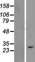 CYB561D1 Protein - Western validation with an anti-DDK antibody * L: Control HEK293 lysate R: Over-expression lysate