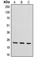 CYB561D2 Antibody - Western blot analysis of CYB561D2 expression in HeLa (A); mouse liver (B); rat kidney (C) whole cell lysates.