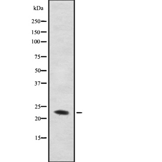 CYB561D2 Antibody - Western blot analysis of C56D2 using COS7 whole cells lysates