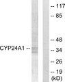 CYB561D2 Antibody - Western blot analysis of extracts from Jurkat cells, using C56D2 antibody.