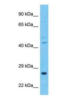 CYB561D2 Antibody - Western blot of CYB561D2 Antibody with human HeLa Whole Cell lysate.  This image was taken for the unconjugated form of this product. Other forms have not been tested.