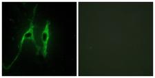 CYB5A / Cytochrome b5 Antibody - Immunofluorescence analysis of NIH/3T3 cells, using CYB5 Antibody. The picture on the right is blocked with the synthesized peptide.