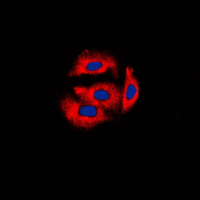 CYB5A / Cytochrome b5 Antibody - Immunofluorescent analysis of Cytochrome b5A staining in HeLa cells. Formalin-fixed cells were permeabilized with 0.1% Triton X-100 in TBS for 5-10 minutes and blocked with 3% BSA-PBS for 30 minutes at room temperature. Cells were probed with the primary antibody in 3% BSA-PBS and incubated overnight at 4 C in a humidified chamber. Cells were washed with PBST and incubated with a DyLight 594-conjugated secondary antibody (red) in PBS at room temperature in the dark. DAPI was used to stain the cell nuclei (blue).