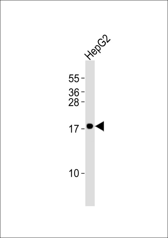 CYB5A / Cytochrome b5 Antibody - Anti-Cytochrome b5A Antibody at 1:1000 dilution + HepG2 whole cell lysates Lysates/proteins at 20 ug per lane. Secondary Goat Anti-Rabbit IgG, (H+L),Peroxidase conjugated at 1/10000 dilution Predicted band size : 15 kDa Blocking/Dilution buffer: 5% NFDM/TBST.
